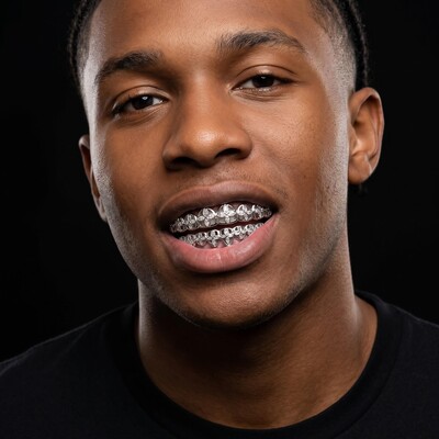 Pre-made Iced Out Four-leaf Clover Grillz Set