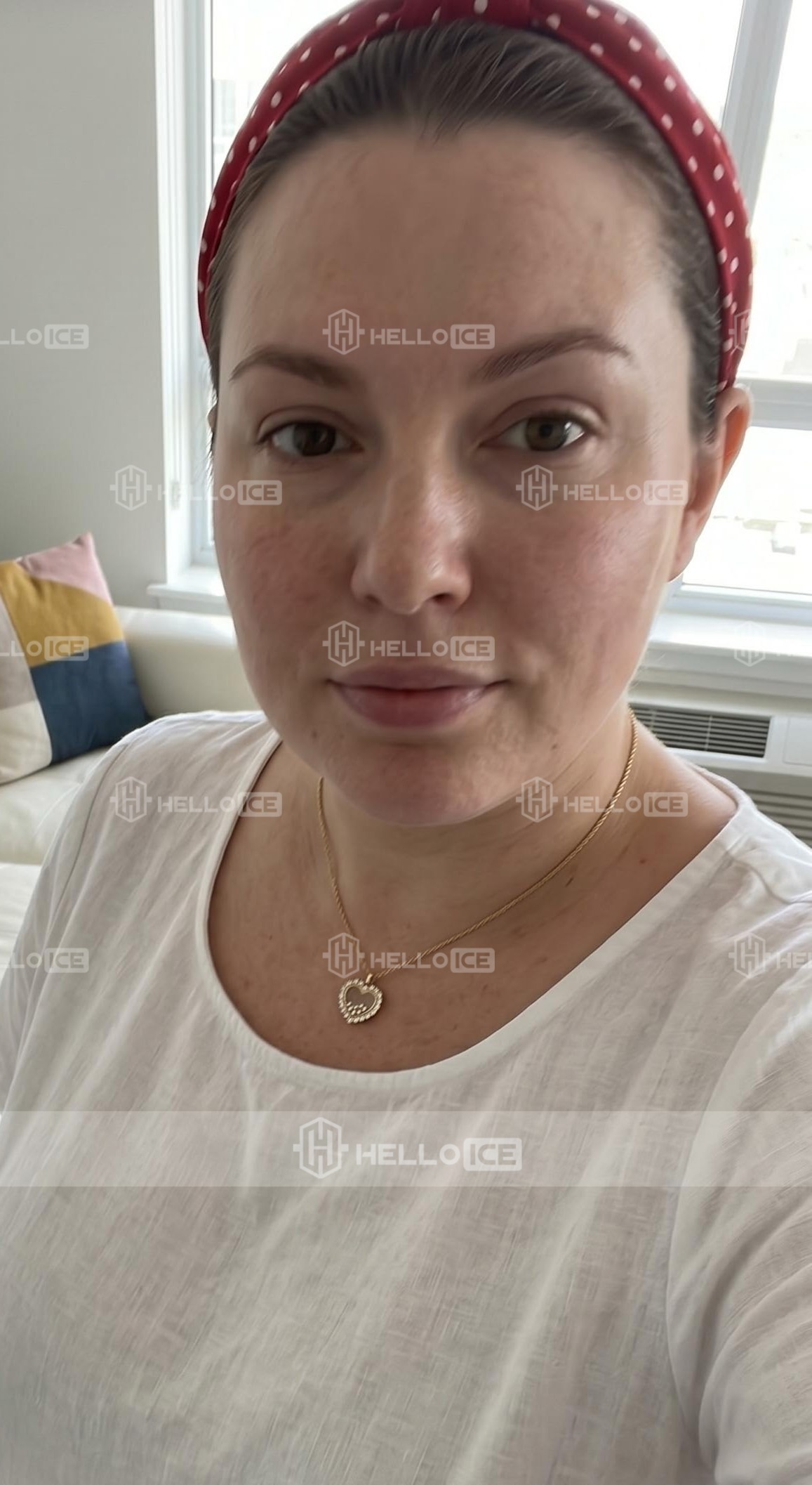 Helloice Review Image