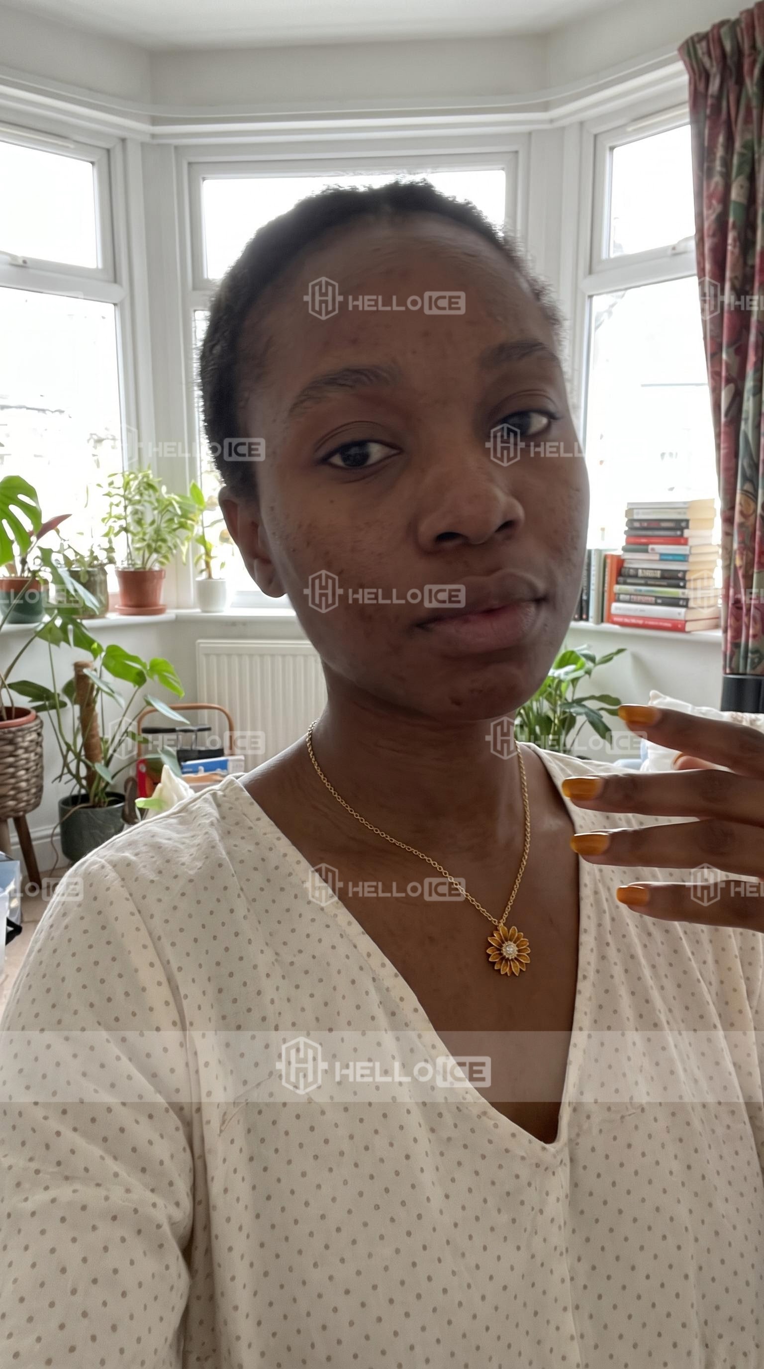Helloice Review Image
