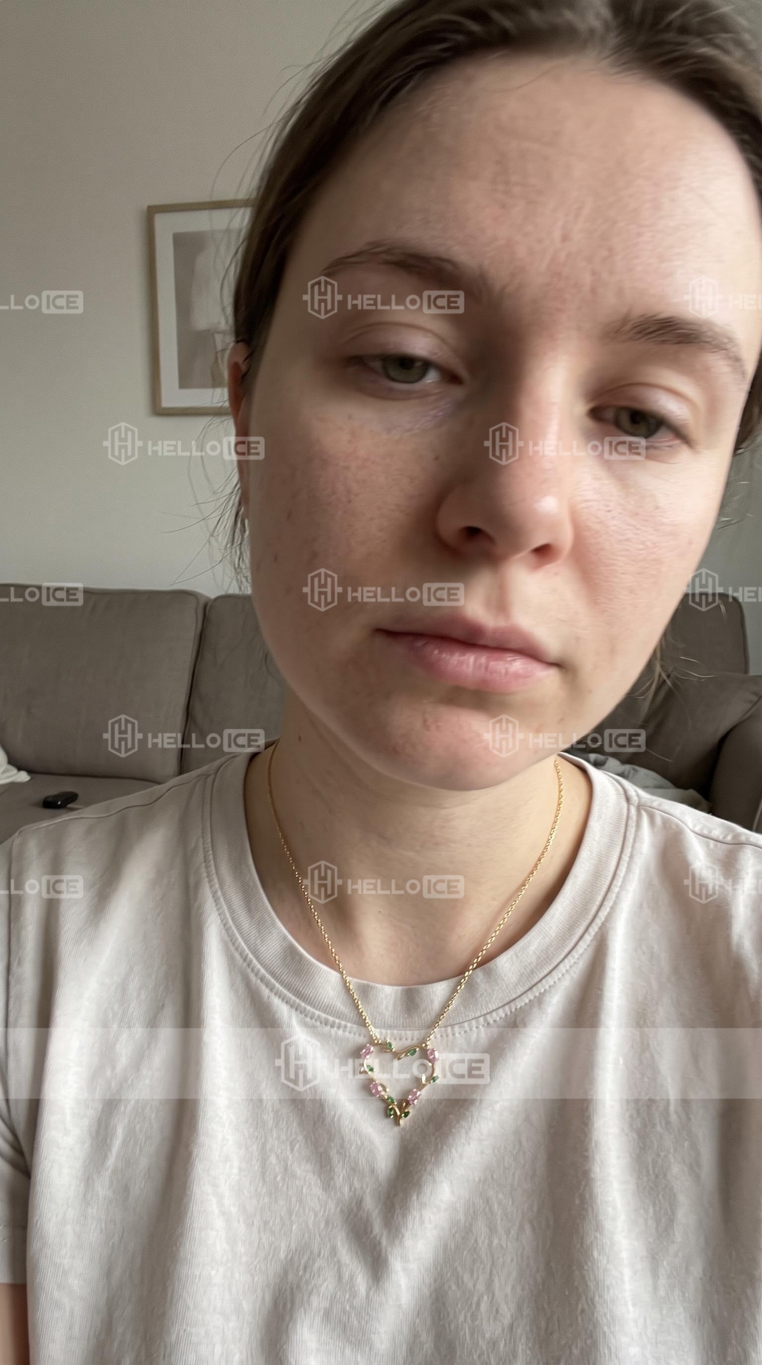 Helloice Review Image