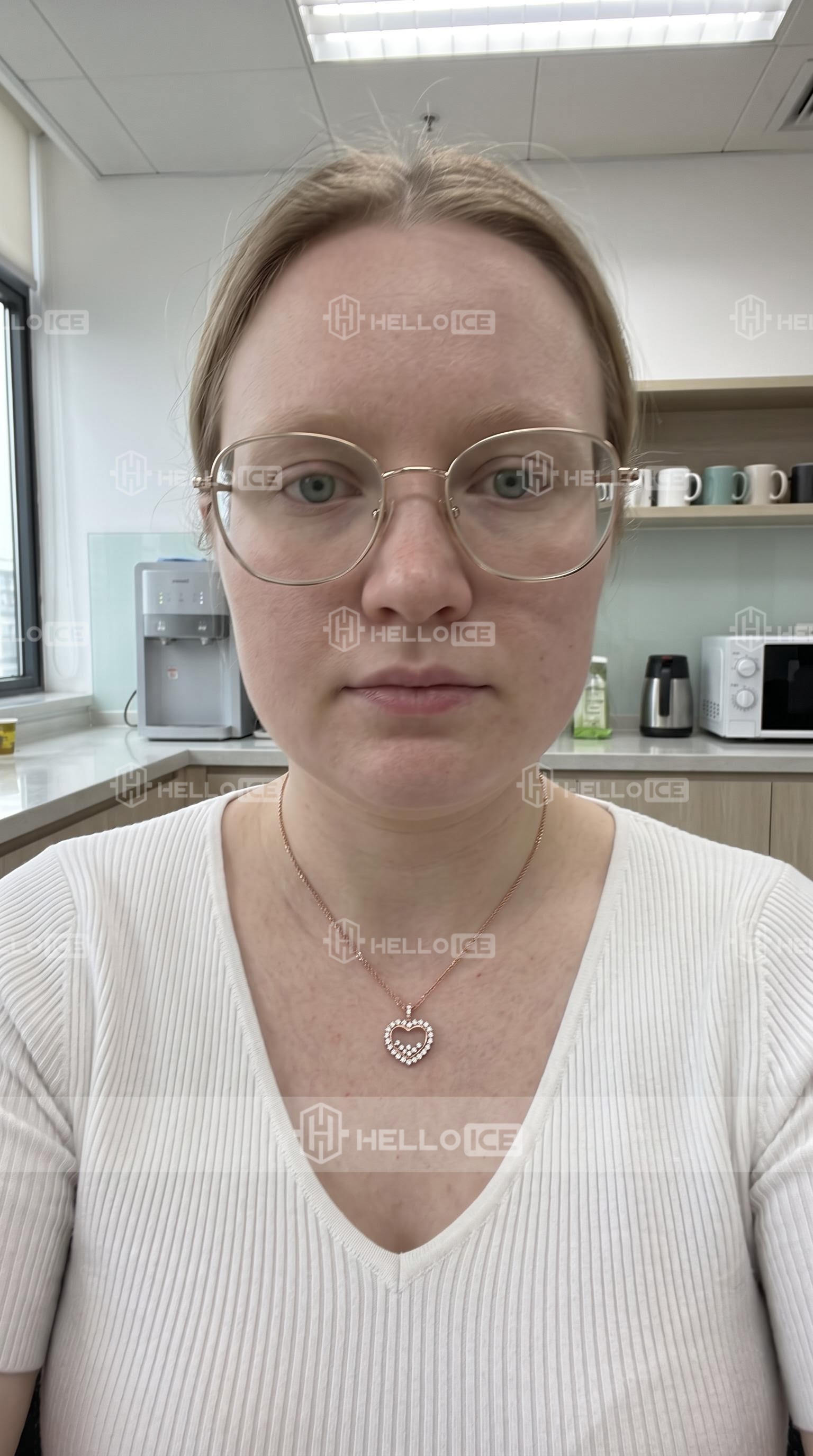 Helloice Review Image