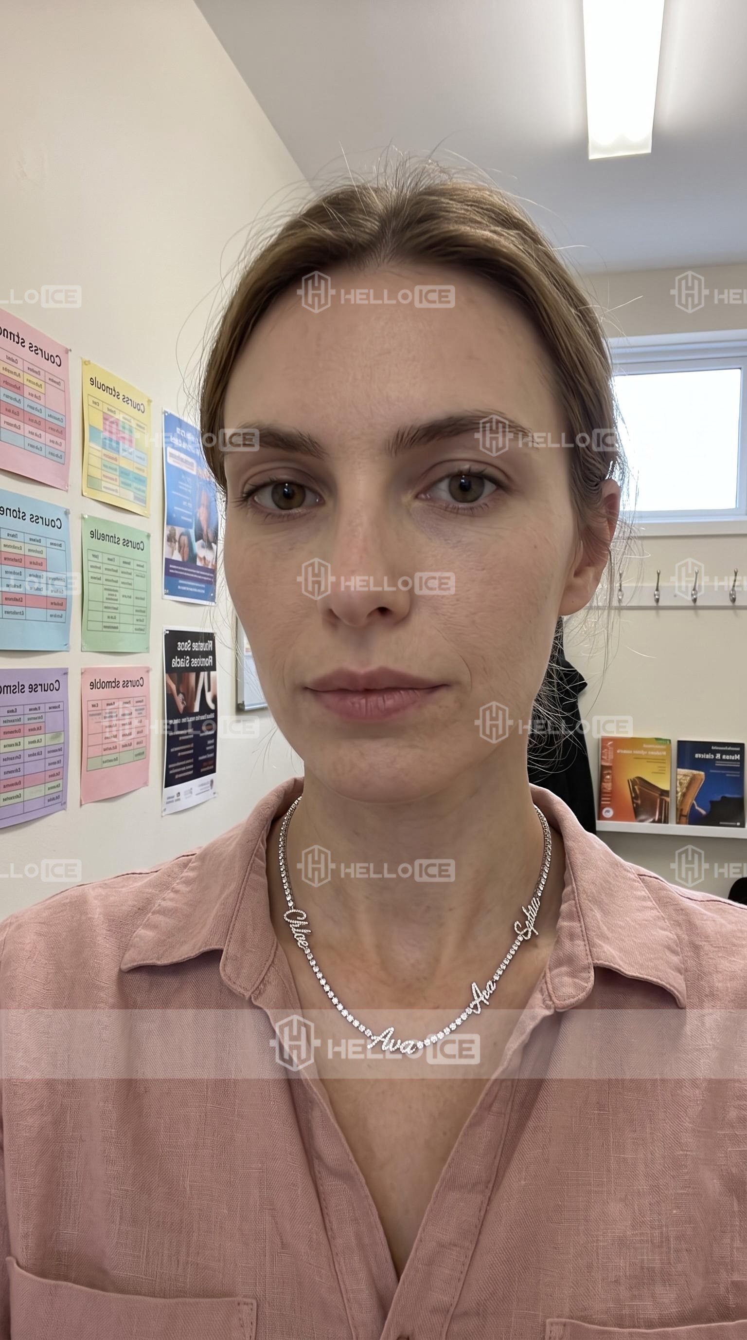 Helloice Review Image