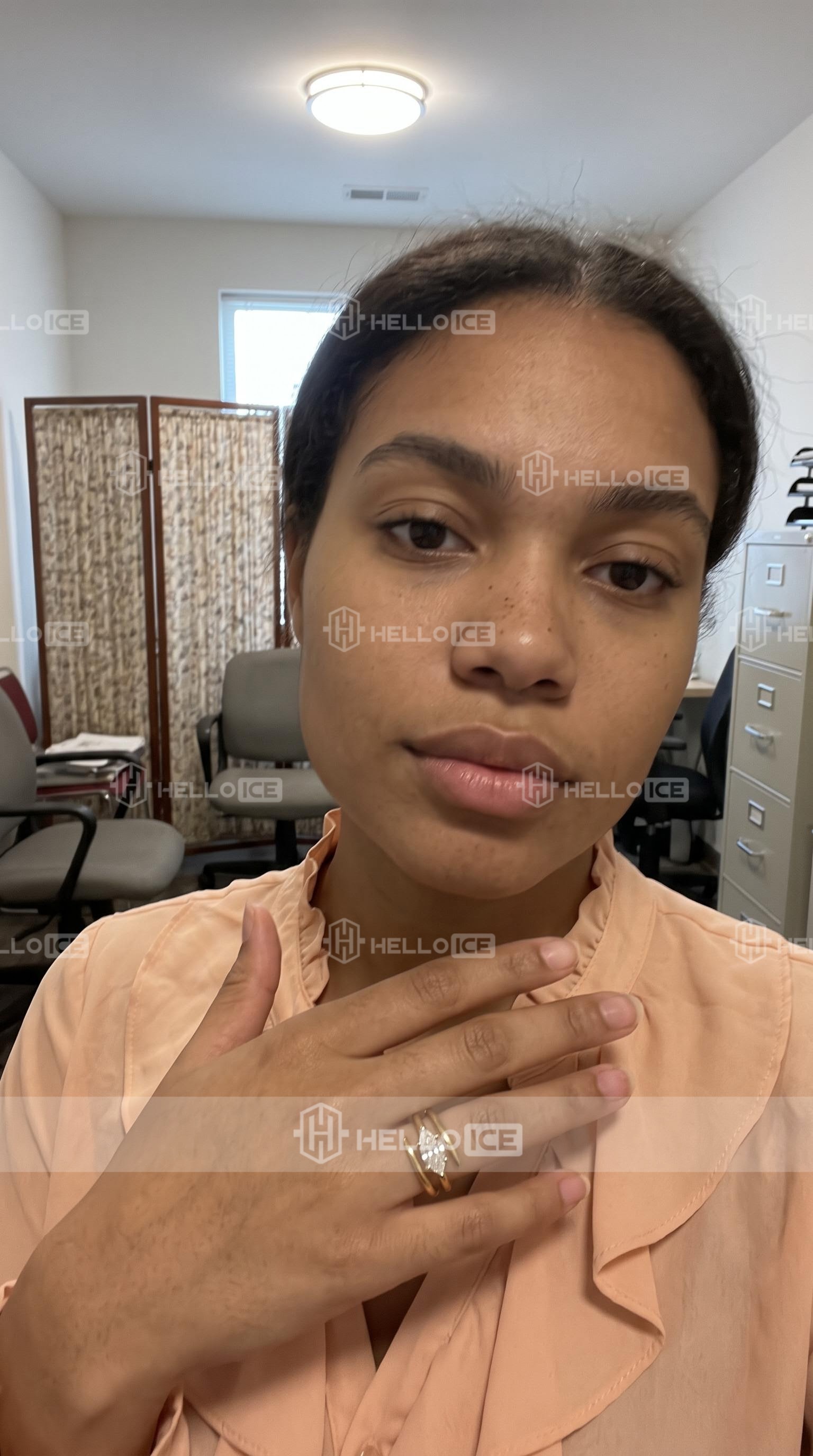 Helloice Review Image