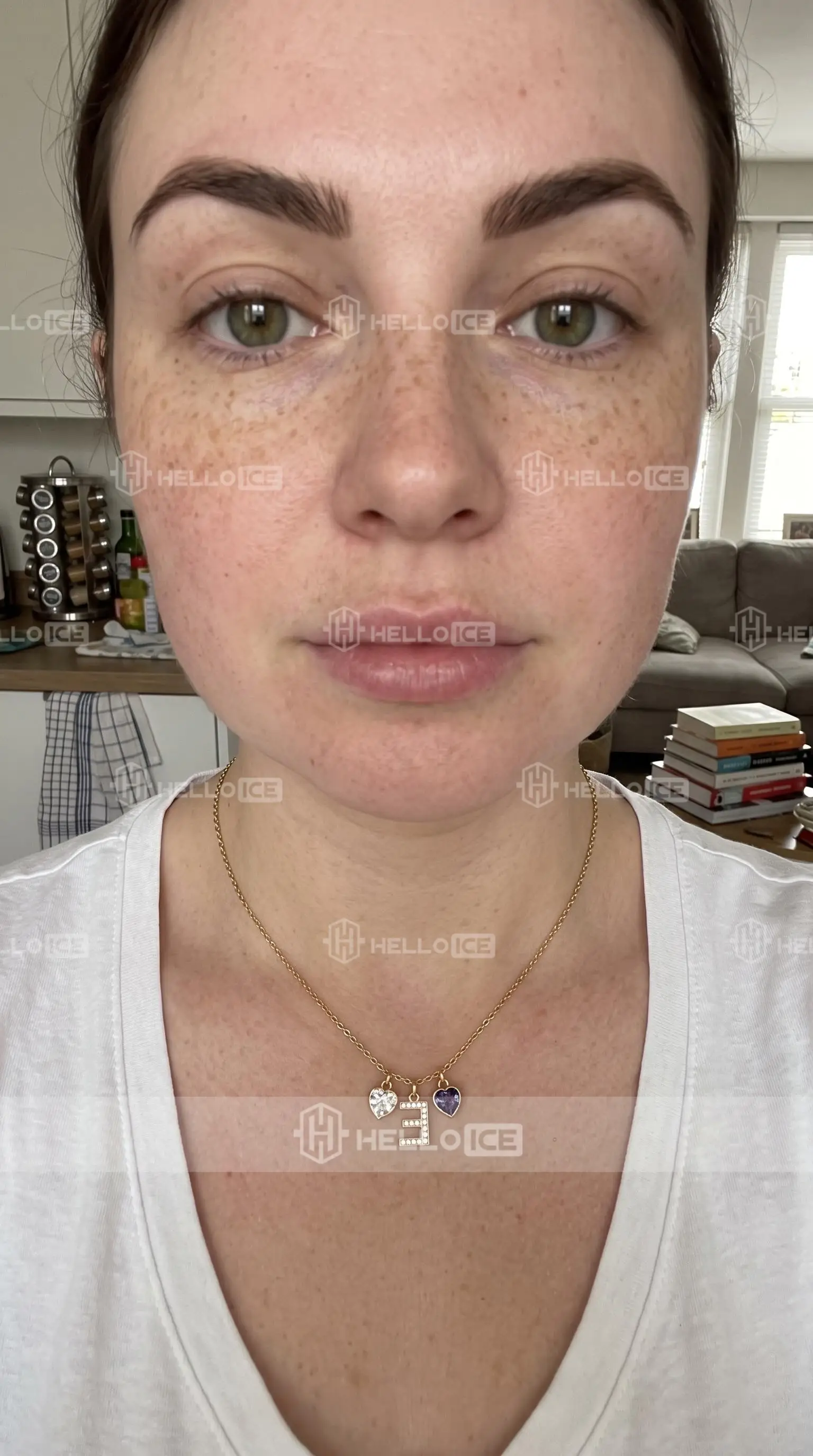 Helloice Review Image
